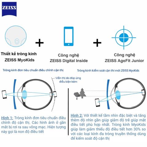  Zeiss MyoKids PhotoFusion X – Tròng Kính Đổi Màu Trẻ Em Kiểm Soát Cận Thị 