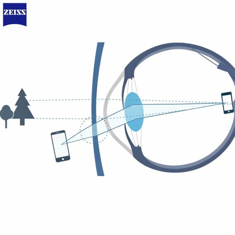  Zeiss MyoKids PhotoFusion X – Tròng Kính Đổi Màu Trẻ Em Kiểm Soát Cận Thị 