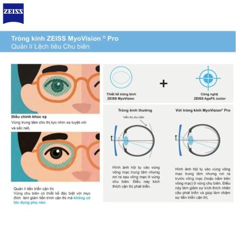 Zeiss MyoVision Pro – Tròng Kính Kiểm Soát Cận Thị Trẻ Em Thế Hệ Mới 
