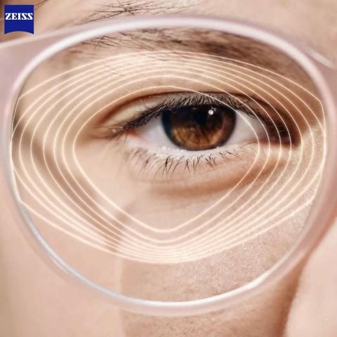  Zeiss MyoVision Pro – Tròng Kính Kiểm Soát Cận Thị Trẻ Em Thế Hệ Mới 