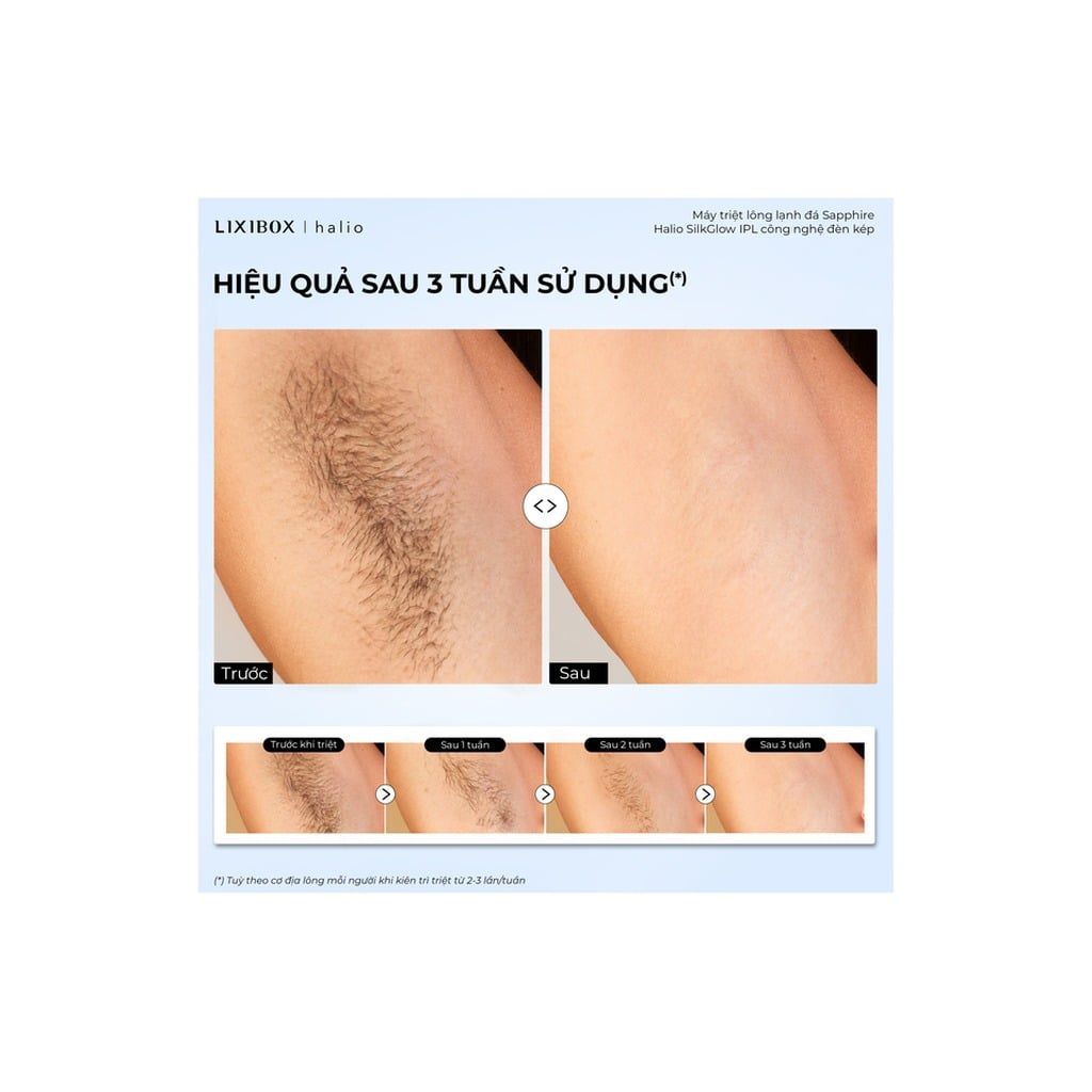 Máy Triệt Lông Halio SilkGlow IPL Sapphire Cooling Hair Removal Device