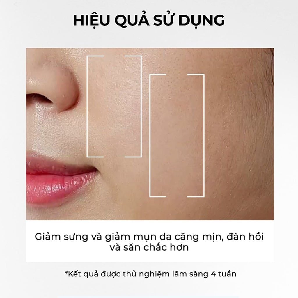 Máy rửa mặt massage tích hợp liệu pháp ánh sáng và nhiệt Halio ( Xanh Trầm/Hồng Đào/Xanh Dương)