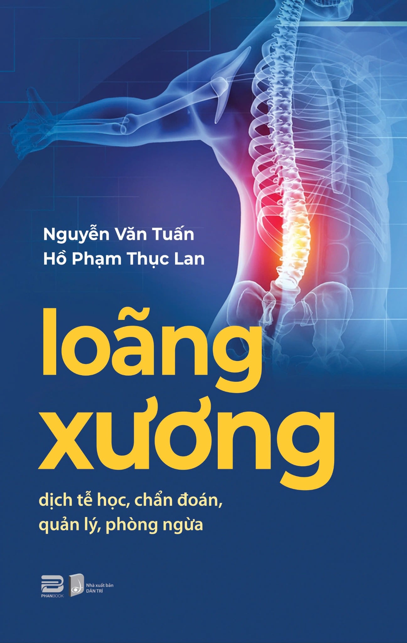 LOÃNG XƯƠNG - DỊCH TỄ HỌC, CHẨN ĐOÁN, QUẢN LÝ, PHÒNG NGỪA - NGUYỄN VĂN TUẤN & HỒ PHẠM THỤC LAN