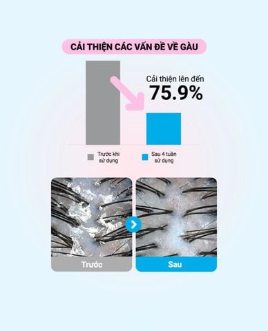  MOREMO - Dầu gội Fresh & Cool Dandruff 
