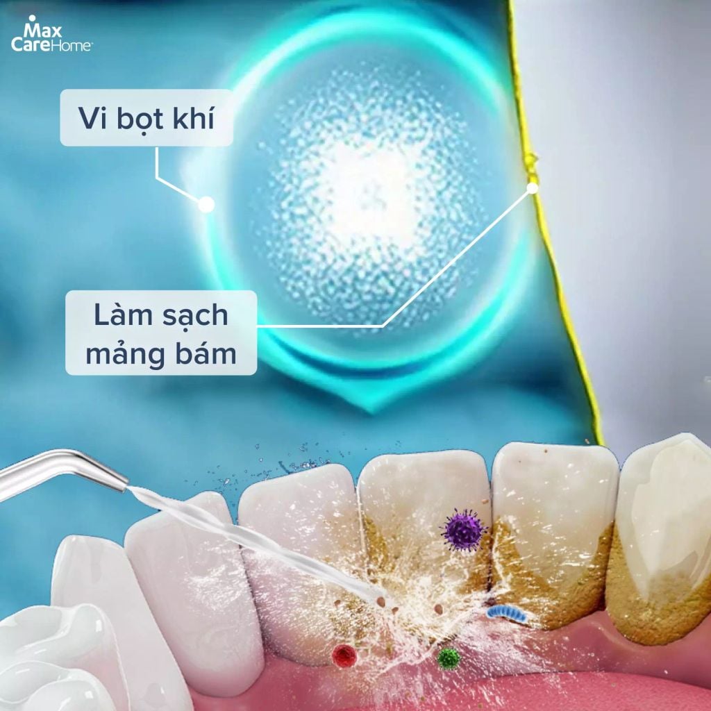 Máy tăm nước công nghệ Nhật Bản Maxcare Max468Prime