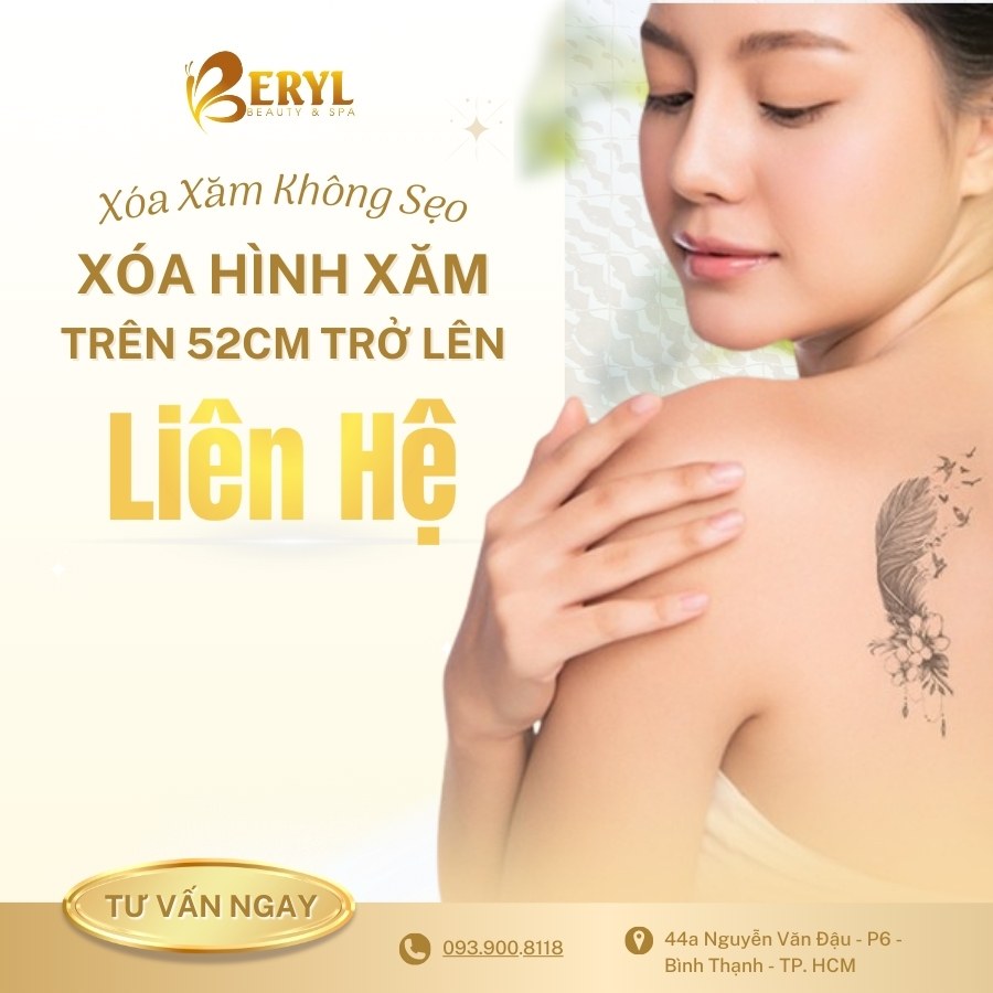 Xóa Hình Xăm Trên 52cm Trở Lên