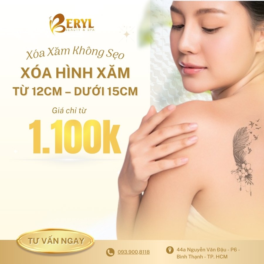 Xóa Hình Xăm Từ 12cm – Dưới 15cm