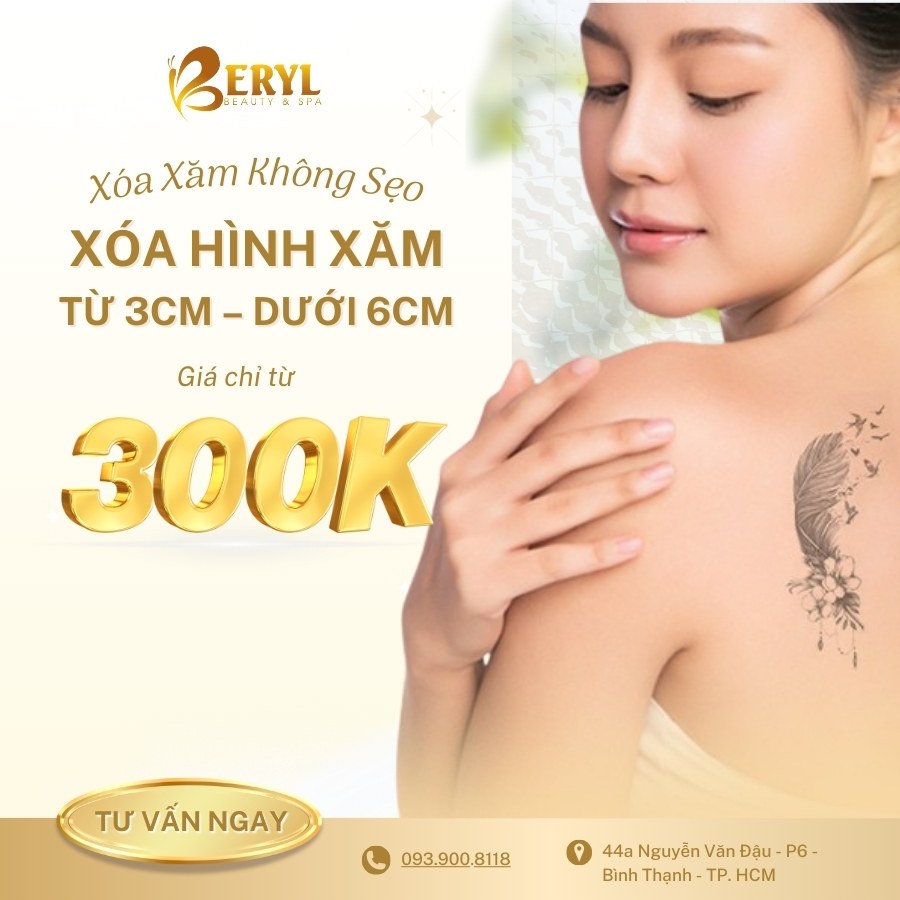 Xóa Hình Xăm Từ 3cm – Dưới 6cm
