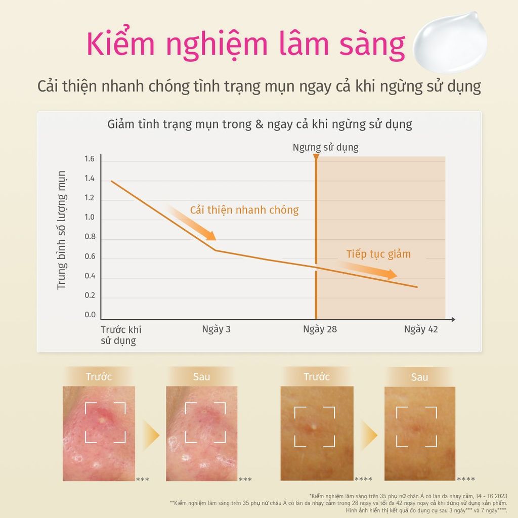  A33: DEAL 17: COMBO ESSENCE GIẢM MỤN VÀ LÀM MỜ VẾT THÂM D PROGRAM ACNE CARE SPOT ESSENCE 15G VÀ KEM DƯỠNG PHỤC HỒI DA MICROBIOME SKIN REPAIR CREAM 45G 