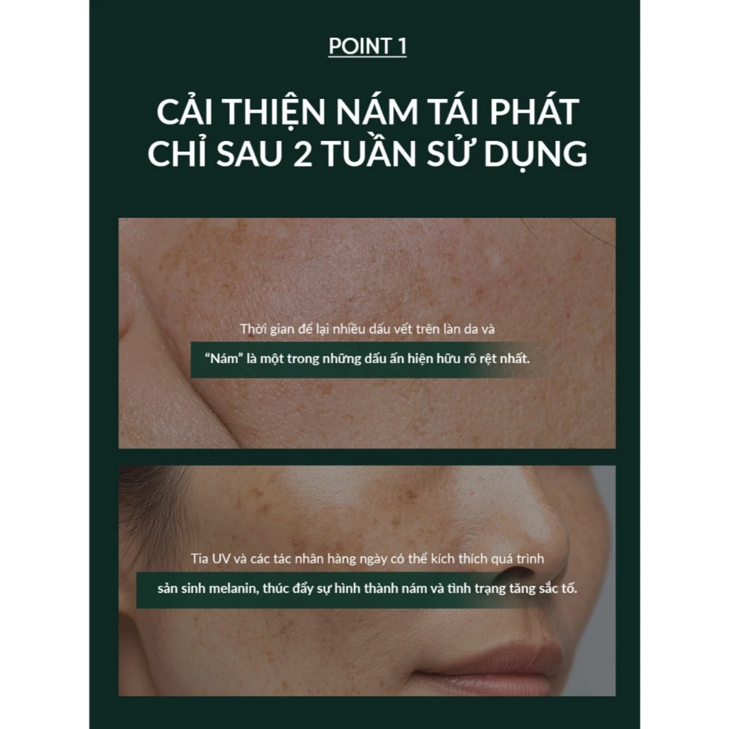  KEM NỀN DẠNG NÉN GIÀU DƯỠNG CHẤT OHUI ULTIMATE COVER DENIER PACT SPF50+/PA+++ - A379 