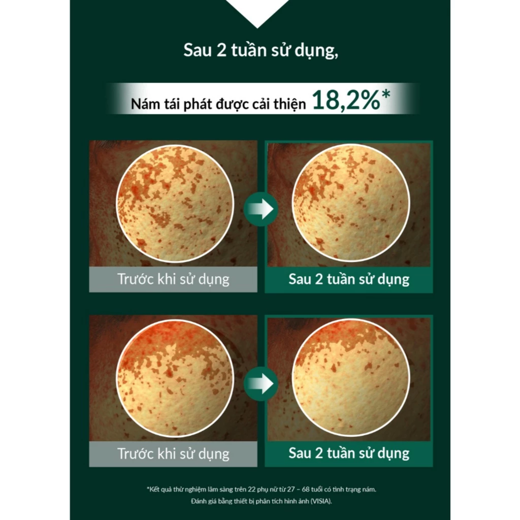  KEM NỀN DẠNG NÉN GIÀU DƯỠNG CHẤT OHUI ULTIMATE COVER DENIER PACT SPF50+/PA+++ - A379 