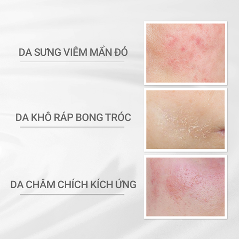  A27_DEAL 1: BỘ ĐÔI KEM DƯỠNG ẨM VÀ PHỤC HỒI DA D PROGRAM SKIN REPAIR CREAM 45G 