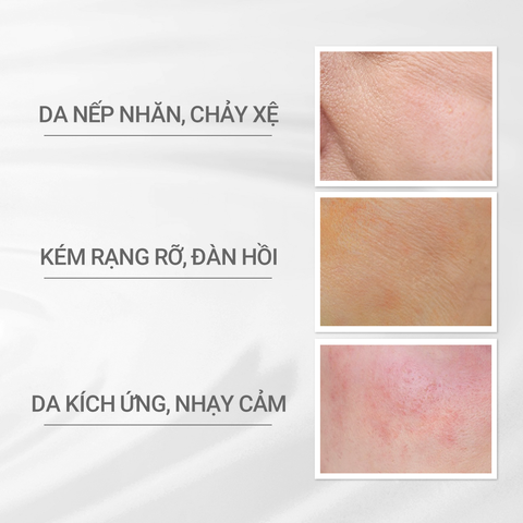  A29_DEAL 11: KEM DƯỠNG NGĂN NGỪA LÃO HÓA D PROGRAM VITALIZING CREAM 45G 