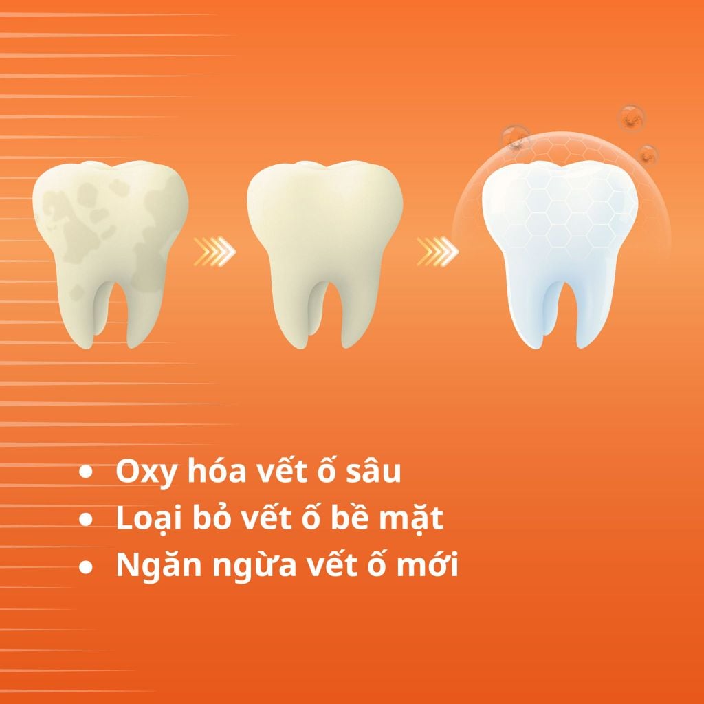  COMBO 2 KEM ĐÁNH RĂNG ZENYUM GIẢM Ê BUỐT / LÀM TRẮNG RĂNG 100G - A1757 