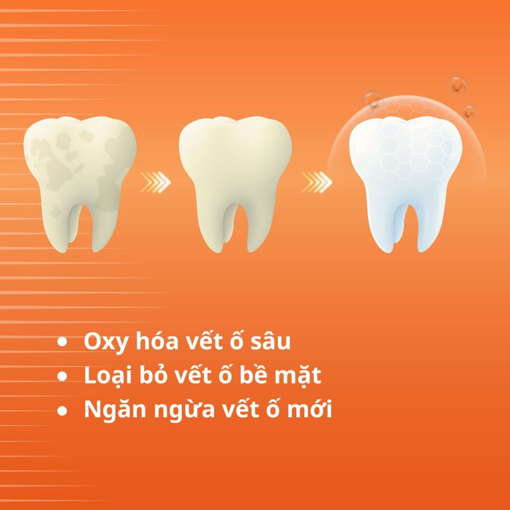  COMBO 2 KEM ĐÁNH RĂNG ZENYUM GIẢM Ê BUỐT / LÀM TRẮNG RĂNG 100G 