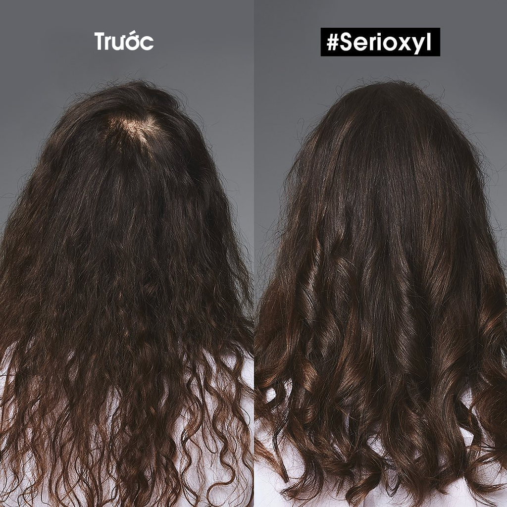  DEAL 13: [PHIÊN BẢN TRẢI NGHIỆM] TINH CHẤT HỖ TRỢ MỌC TÓC L'ORÉAL PROFESSIONNEL SERIOXYL ADVANCED 30ML 