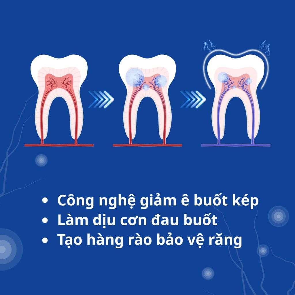  COMBO 2 KEM ĐÁNH RĂNG ZENYUM GIẢM Ê BUỐT / LÀM TRẮNG RĂNG 100G 