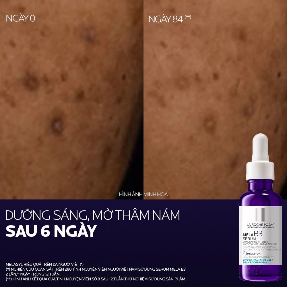  DƯỠNG CHẤT GIẢM THÂM NÁM VÀ DƯỠNG SÁNG LA ROCHE-POSAY MELA B3 SERUM 30ML - E609 