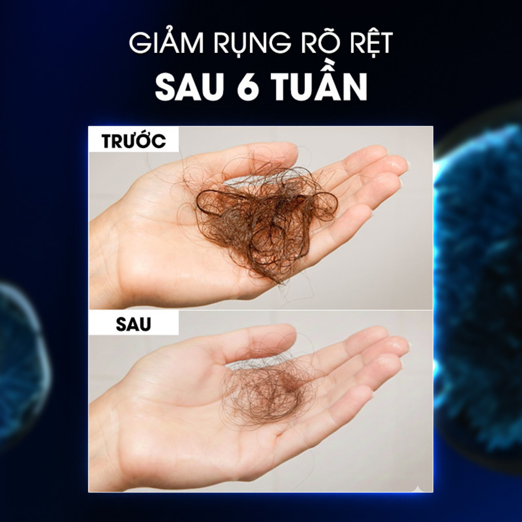  DEAL 10: [MỞ BÁN ĐỘC QUYỀN] TINH CHẤT XỊT GIẢM RỤNG TÓC CHUYÊN NGHIỆP L'ORÉAL PROFESSIONNEL AMINEXIL ADVANCED 90ml 