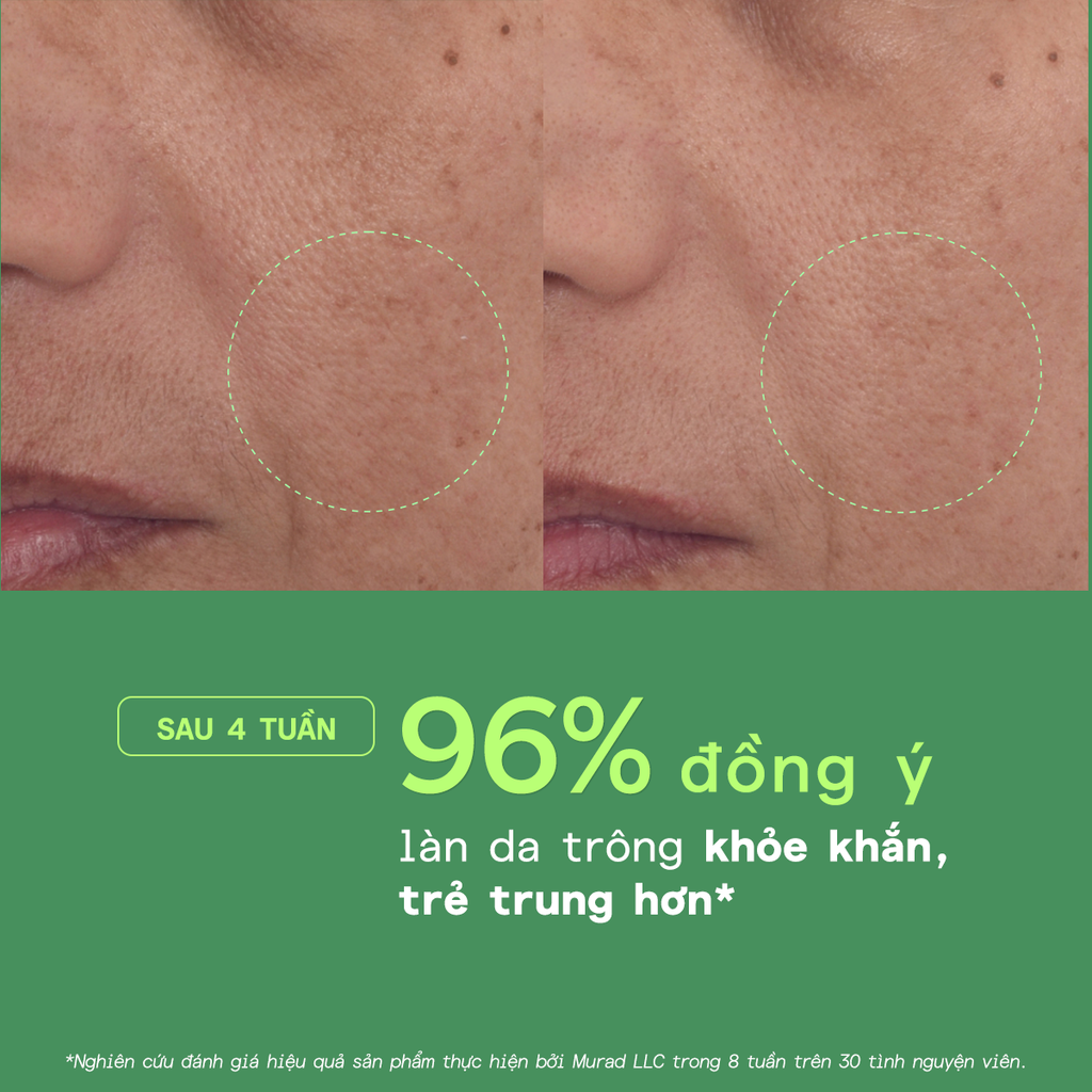  [FLASH DEAL 10]: [NEW] TINH CHẤT RETINOL GIÚP DA MỊN MÀNG VÀ LÀM MỜ NẾP NHĂN 30ML 