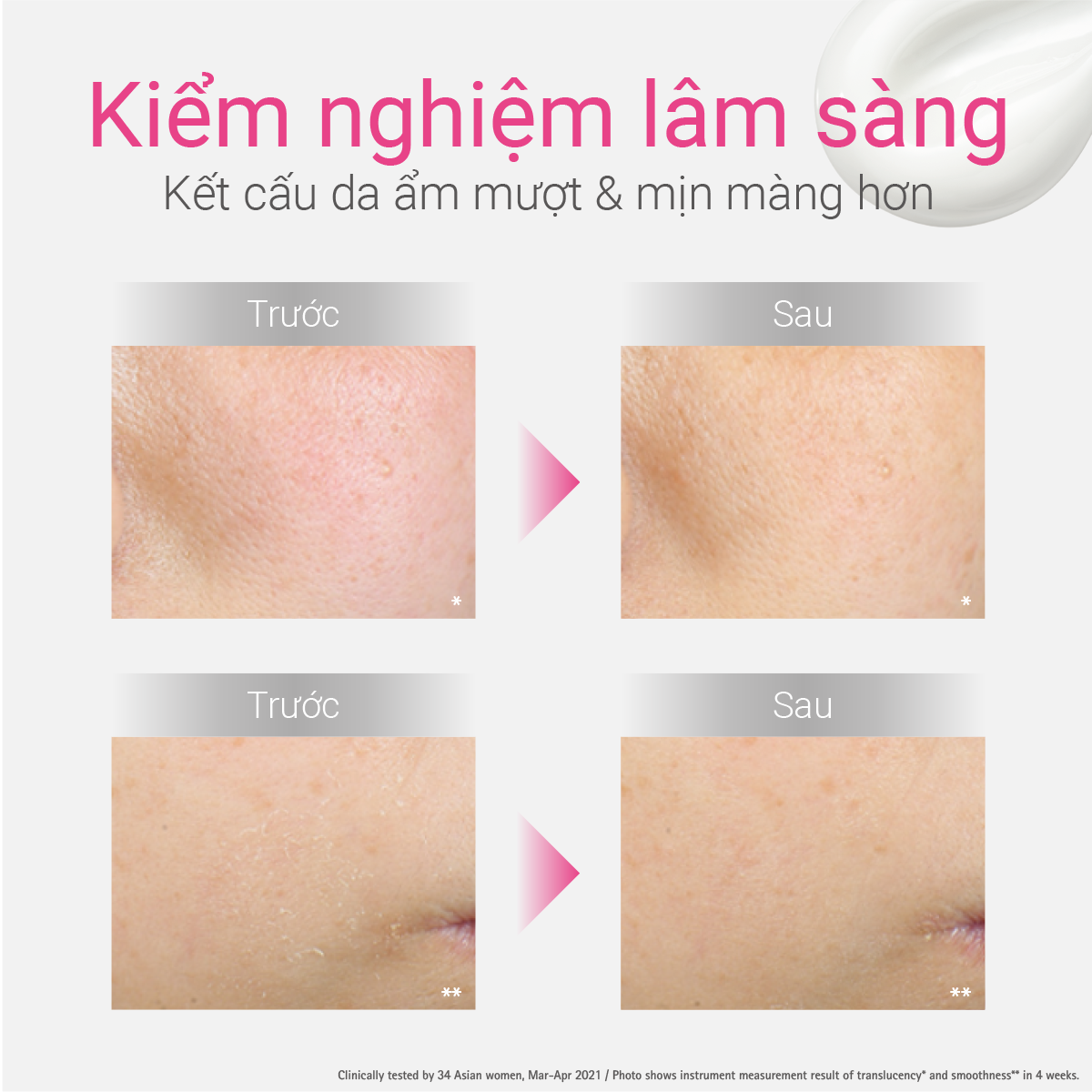  A36_DEAL 5: KEM DƯỠNG ẨM VÀ PHỤC HỒI DA D PROGRAM SKIN REPAIR CREAM 45G 