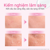  A55_DEAL 15: SERUM GIÚP CẢI THIỆN TÌNH TRẠNG LÃO HÓA SỚM DPROGRAM INTENSE ENRICHING SERUM 45ML 