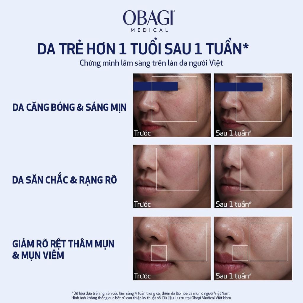  DEAL 1: [MỚI] DEAL SỐC MUA 1 TẶNG 1 - SERUM TRẺ HÓA DA CẤP ĐỘ TẾ BÀO NU-GEN™ 30ML 