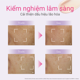  A29_DEAL 11: KEM DƯỠNG NGĂN NGỪA LÃO HÓA D PROGRAM VITALIZING CREAM 45G 