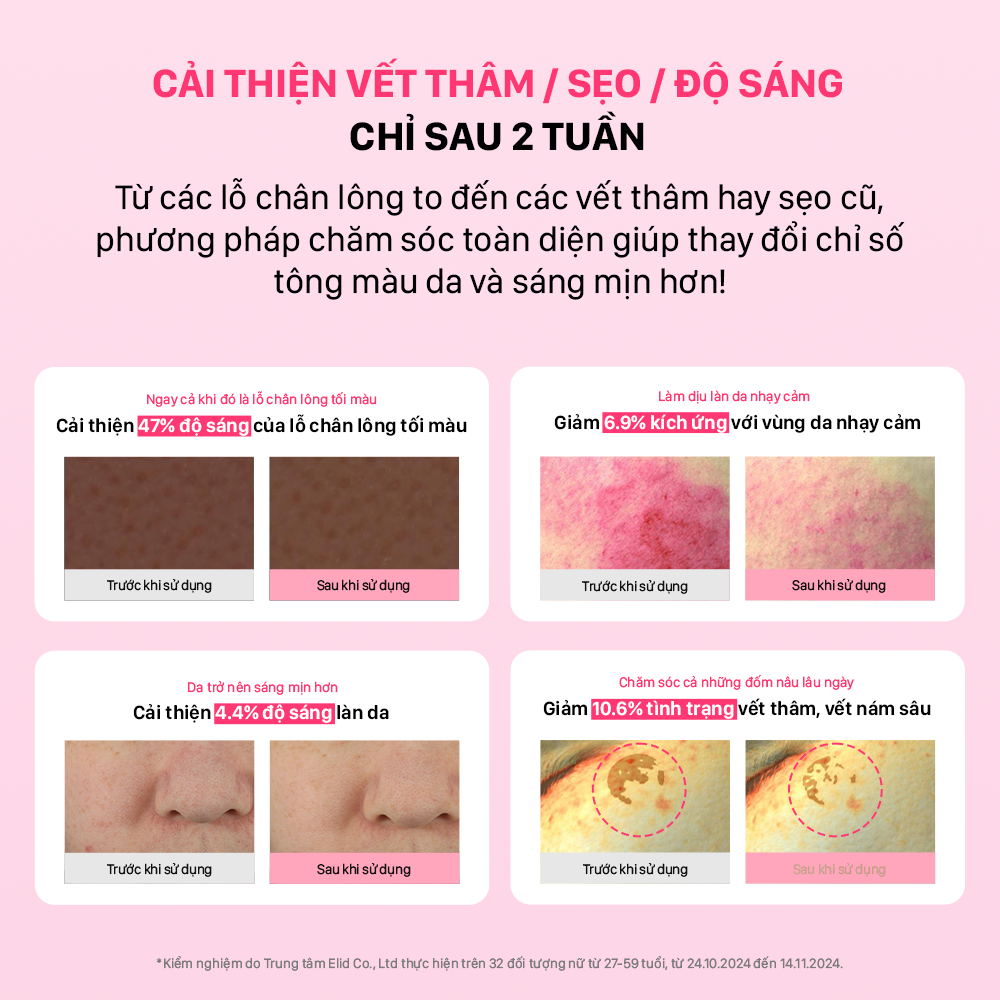  DEAL 55: MỚI RA MẮT - TINH CHẤT VI KIM DƯỠNG SÁNG HỒNG DA CNP DERMA ANSWER PINK TONING AMPOULE 30ML 
