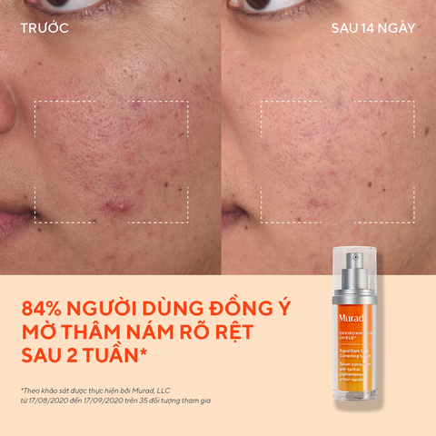  TINH CHẤT LÀM MỜ VẾT NÁM VÀ GIẢM SỰ HÌNH THÀNH ĐỐM NÂU 30ML [FLASH DEAL 8]: - E324 