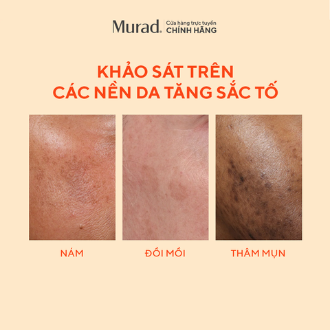  TINH CHẤT LÀM MỜ VẾT NÁM VÀ GIẢM SỰ HÌNH THÀNH ĐỐM NÂU 30ML [FLASH DEAL 8]: - E324 