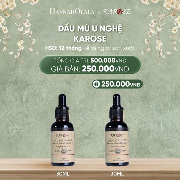  DEAL 17: DẦU MÙ U NGHỆ KAROSE 30ML 