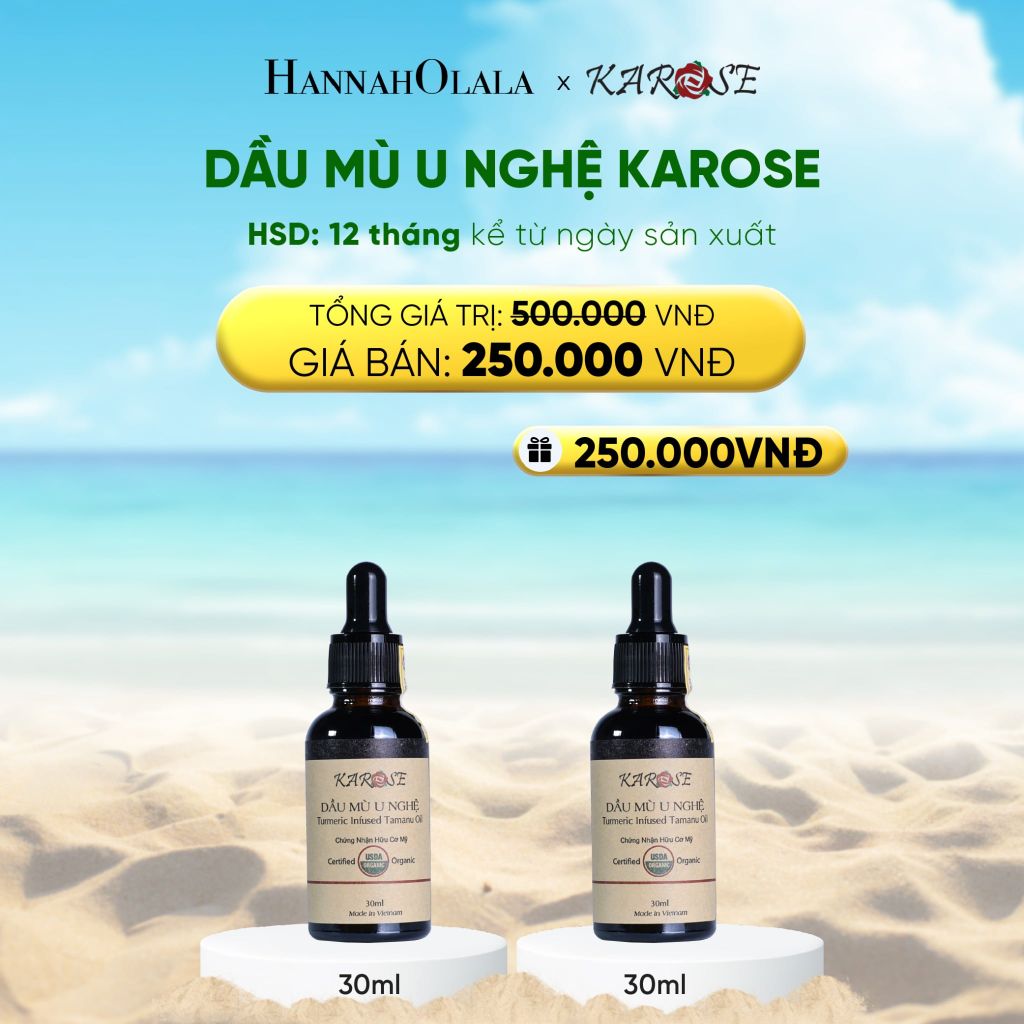  DẦU MÙ U NGHỆ KAROSE 30ML 