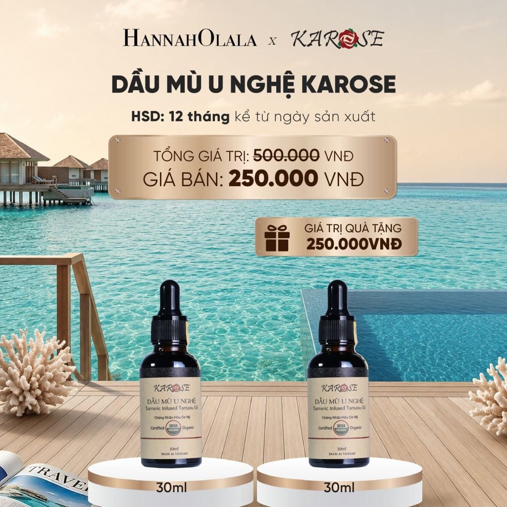  DẦU MÙ U NGHỆ KAROSE 30ML - DEAL 6_ D71 