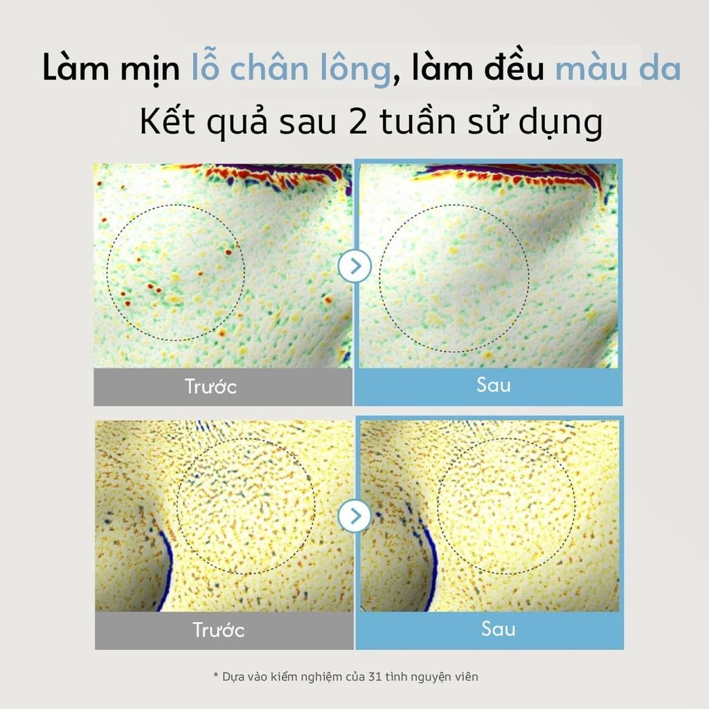  TINH CHẤT DƯỠNG SÁNG, LÀM ĐỀU MÀU DA ALLTIMATE NIACINAMIDE 10% 