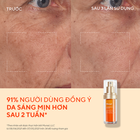  BỘ ĐÔI TINH CHẤT MỜ NÁM VÀ SÁNG DA [FLASH DEAL] DEAL 5: - E321 