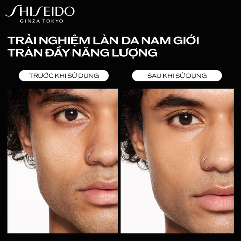 M23_DEAL 2: TINH CHẤT DƯỠNG DA SHISEIDO MEN ULTIMUNE POWER INFUSING CONCENTRATE 30ML (quà tặng date T4/2026) 