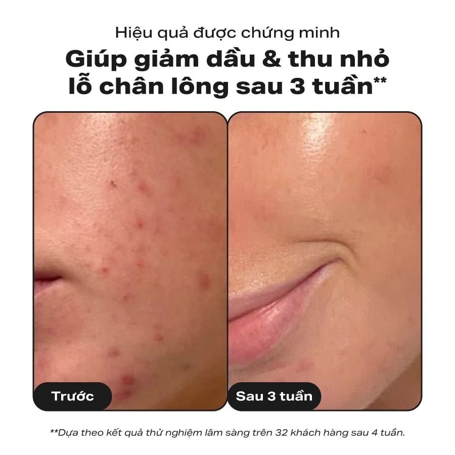  [COMBO] BỘ ĐÔI THU NHỎ LỖ CHÂN LÔNG PAULA'S CHOICE CLINICAL NIACINAMIDE 20% , SKIN PERFECTING 2% BHA LIQUID - DEAL 14 - A1851 