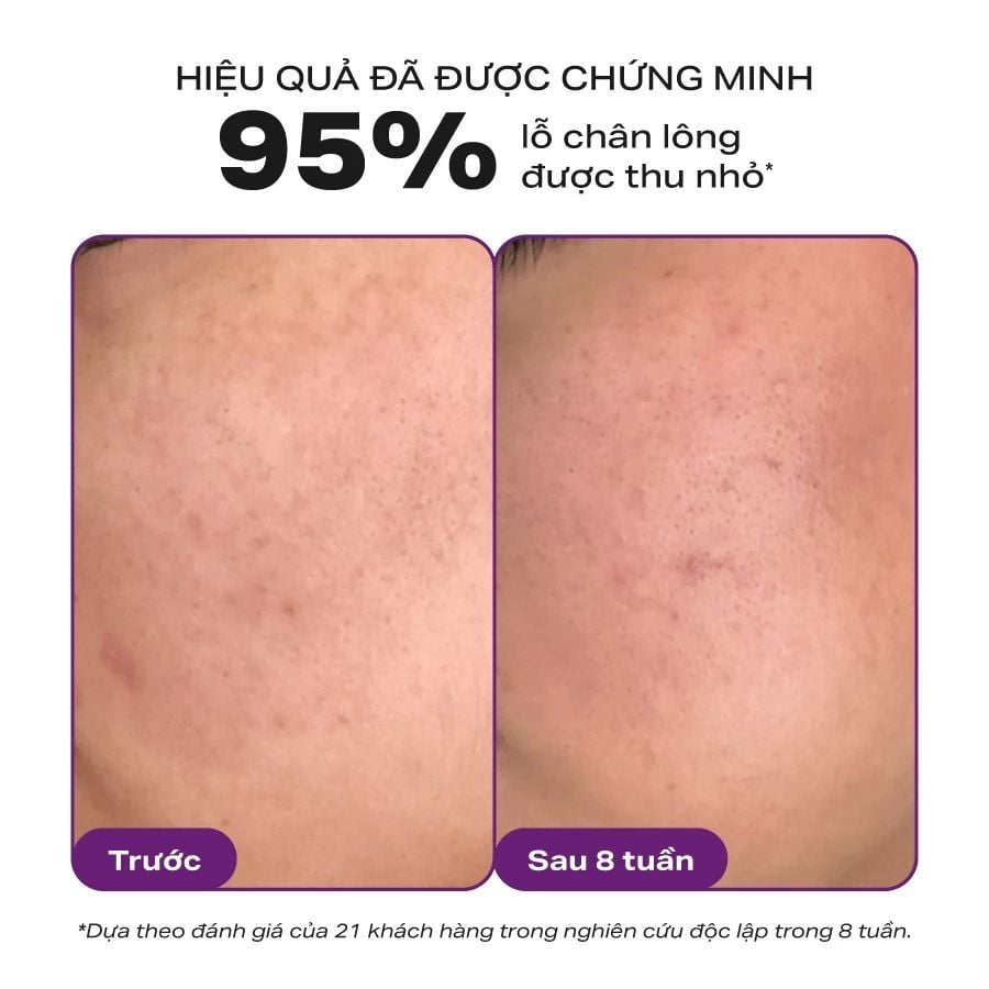  [COMBO] BỘ ĐÔI THU NHỎ LỖ CHÂN LÔNG PAULA'S CHOICE CLINICAL NIACINAMIDE 20% , SKIN PERFECTING 2% BHA LIQUID - DEAL 14 - A1851 