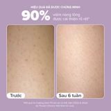 DEAL 7: [PHIÊN BẢN MỚI] KEM DƯỠNG THỂ HỖ TRỢ GIẢM MỤN VÀ LÀM MỊN DA 2% BHA 210ML 