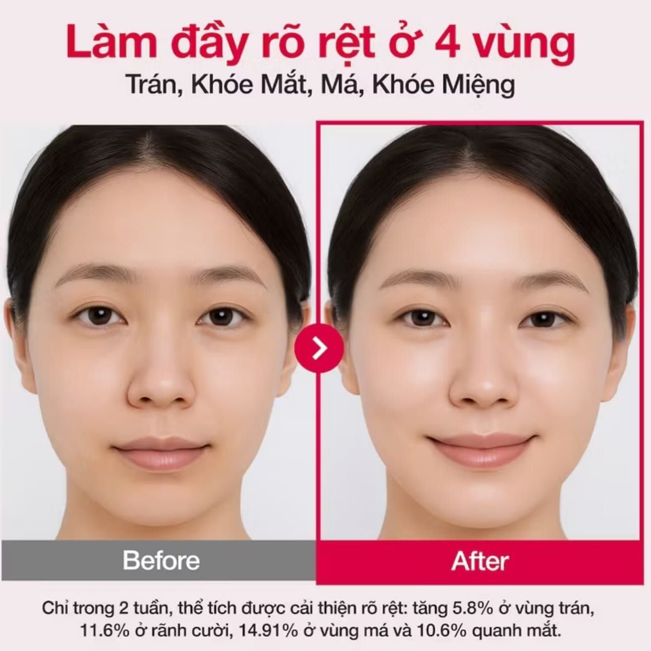  Tinh Chất Cấp Ẩm, Phục Hồi Numbuzin No.2 Rose PDRN Collagen 2X Plumping Serum 30ml (Hũ) 