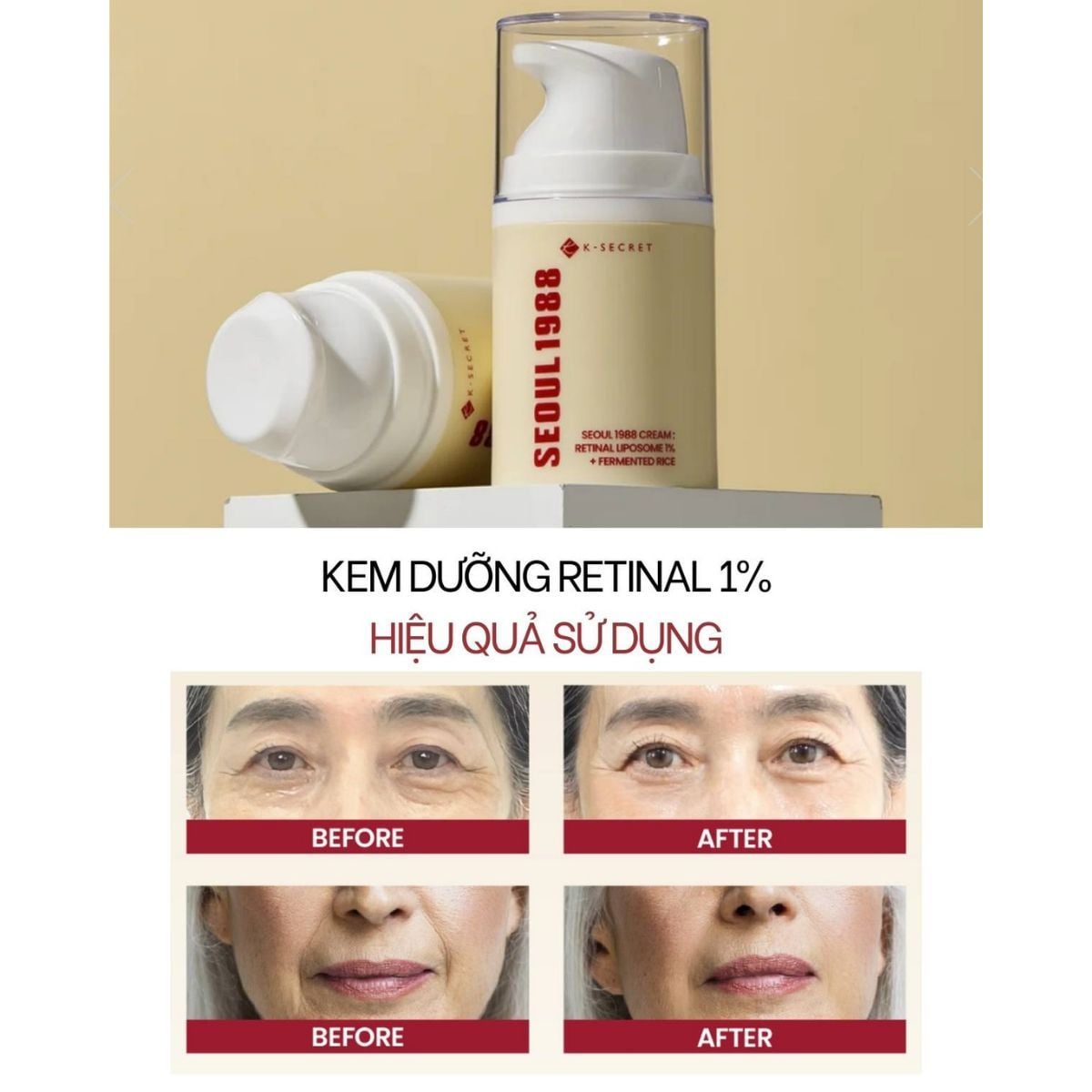  Kem Dưỡng Ngừa Lão Hóa K-Secret Seoul 1988 Retinal Liposome 1% + Fermented Rice Cream 50ml 