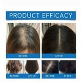  Tinh Chất Dưỡng Da Đầu, Hỗ Trợ Mọc Tóc Seapuri Scalpy Hair Serum 20ml 