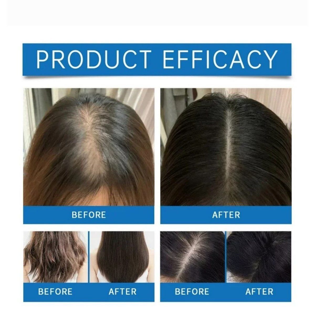  Tinh Chất Dưỡng Da Đầu, Hỗ Trợ Mọc Tóc Seapuri Scalpy Hair Serum 20ml 