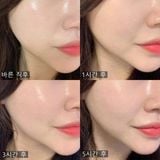  (Mẫu mới) Phấn Nước Renoderm Day Long BB Cream 15g 