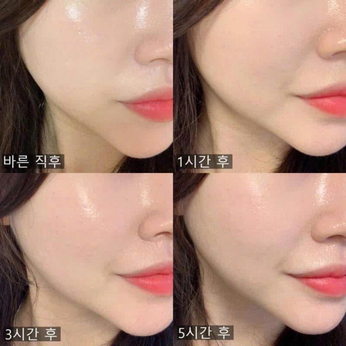  (Mẫu mới) Phấn Nước Renoderm Day Long BB Cream 15g 