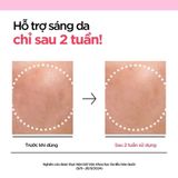  (Mẫu mới) Tinh Chất Dưỡng Trắng, Mờ Thâm Anua Niacinamide 10% + TXA 3% Serum 30ml 