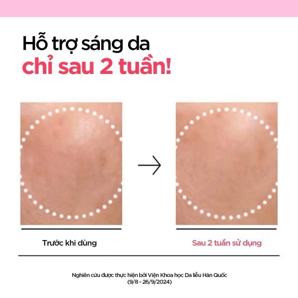  (Mẫu mới) Tinh Chất Dưỡng Trắng, Mờ Thâm Anua Niacinamide 10% + TXA 3% Serum 30ml 