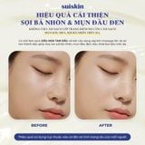  Sáp Tẩy Trang Sạch Sâu Suiskin Blooming Canola Cleansing Balm 90ml 