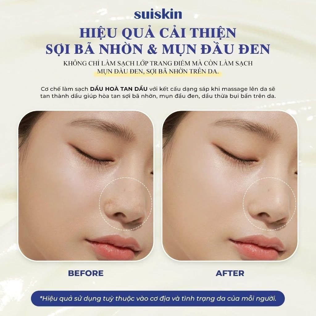  Sáp Tẩy Trang Sạch Sâu Suiskin Blooming Canola Cleansing Balm 90ml 